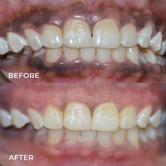 Discover the Magic of a Healthy Bright Smile