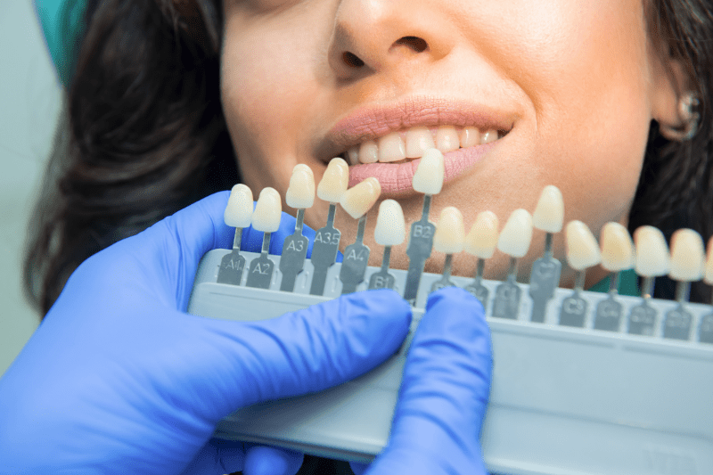 Revitalize Your Smile with Professional Teeth Cleaning - Dr. Aburas Dental