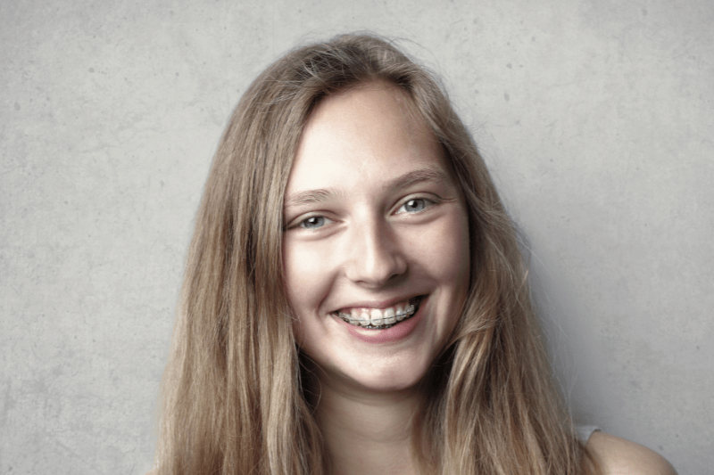 Smile with Confidence: Orthodontic Care at Dr. Aburas Dental Center