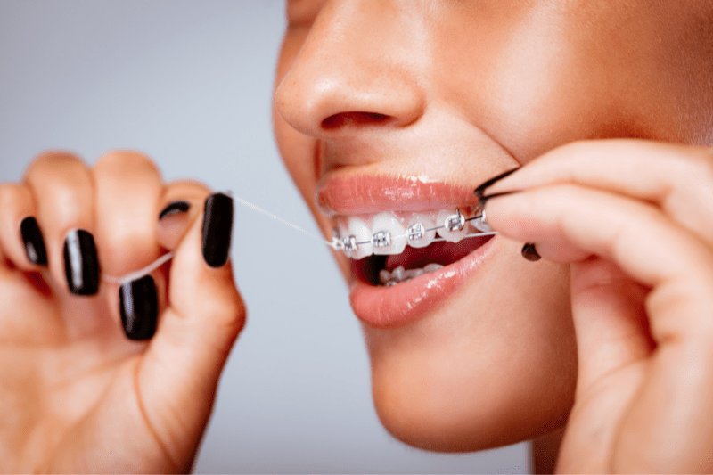 Achieve Straight and Beautiful Teeth with Orthodontic Treatment - Dr. Aburas Dental Center