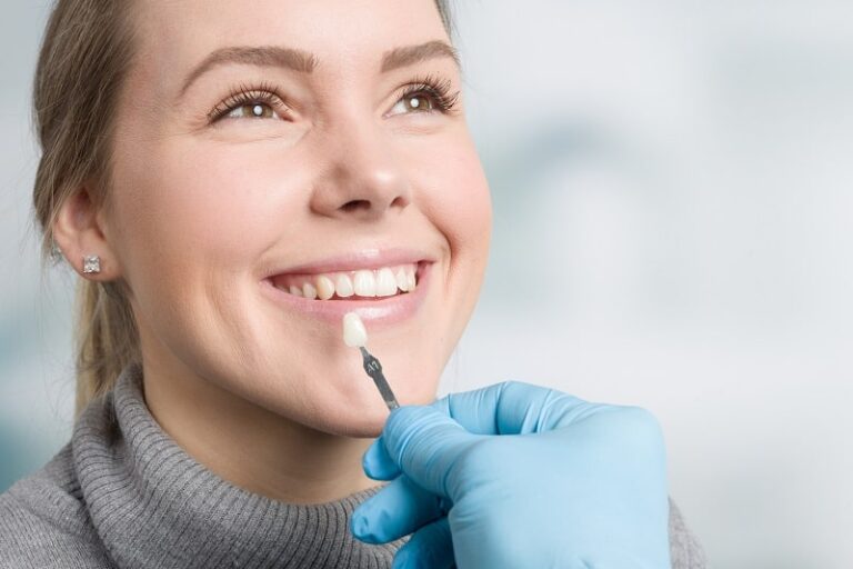 Transforming Smiles with Lumineers - Dr. Aburas Dental