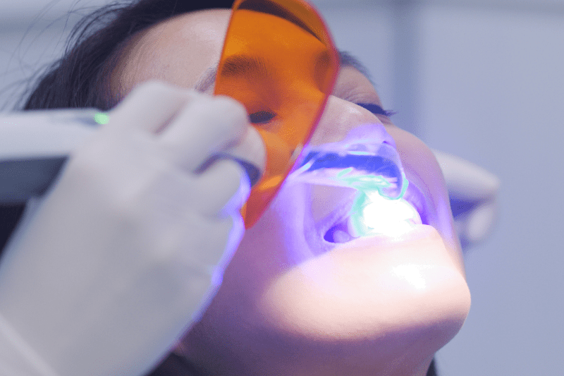 Gentle and Effective Dental Treatments with Laser Dentistry - Dr. Aburas Dental Center