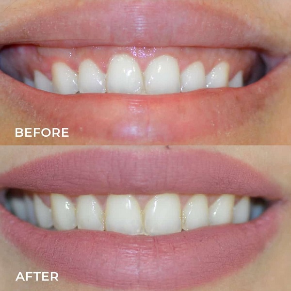 Discover the Magic of a Healthy Bright Smile
