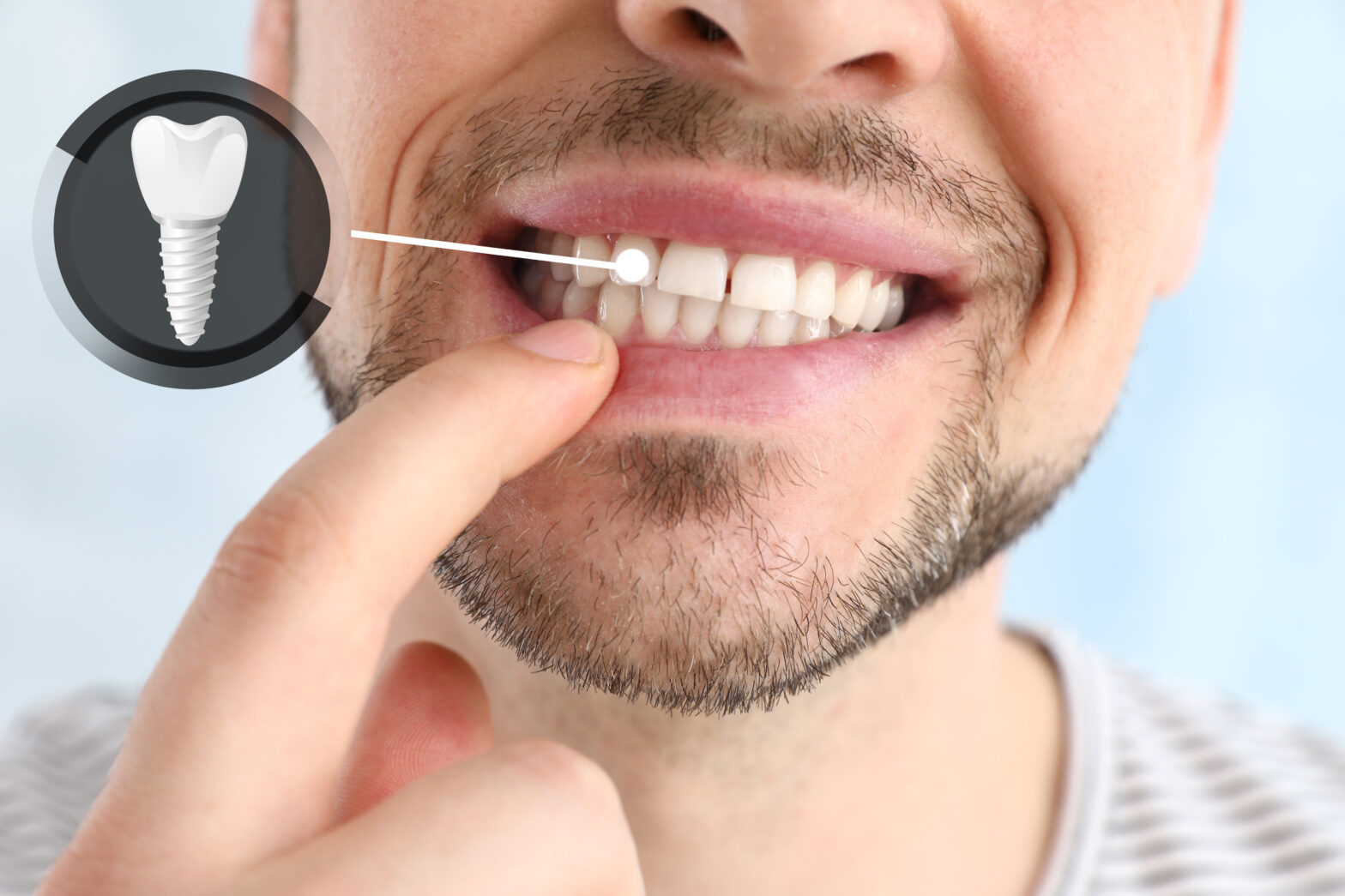 Dr Aburas Denatal Clinic #The Healthy Bright Smile