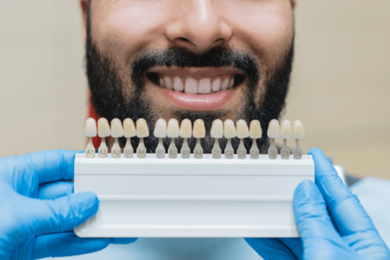 Experience the Joy of a Bright Smile with Teeth Whitening - Dr. Aburas Dental