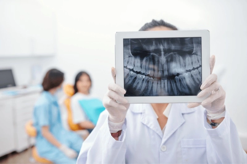 Advanced Dental Imaging: Explore with CT Scan 3D X-Ray at Dr. Aburas Dental Center