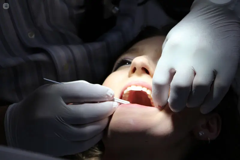 Wisdom Tooth Removal Procedure by Our Dental Specialists in Dubai